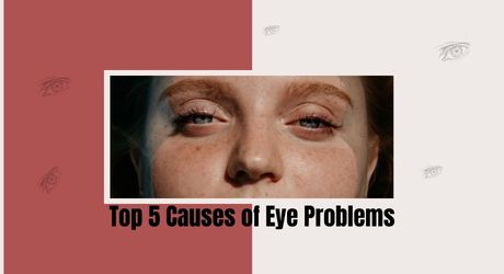 Top 5 Causes of Eye Problems